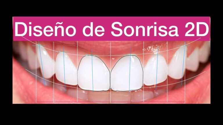 Curso de Dise&ntilde;o Digital de Sonrisa en Chile