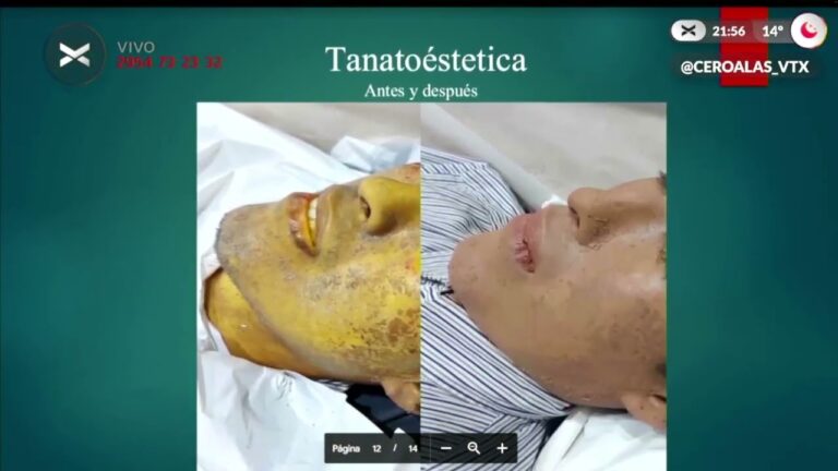 Curso de Tanatopraxia en Chile: Formaci&oacute;n y Oportunidades Profesionales
