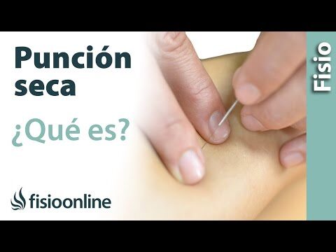 Curso de Puntos Gatillo en Chile: T&eacute;cnicas Efectivas para el Alivio del Dolor