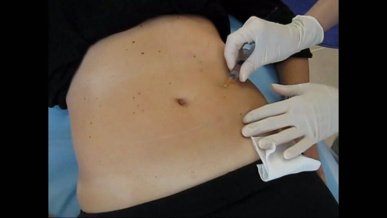 Curso de Mesoterapia Homeop&aacute;tica en Chile