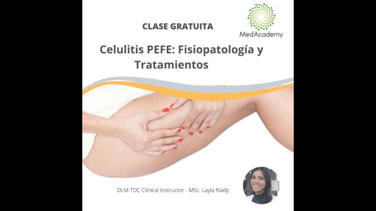 Curso de Carboxiterapia en Chile: Aprendizaje y Aplicaciones