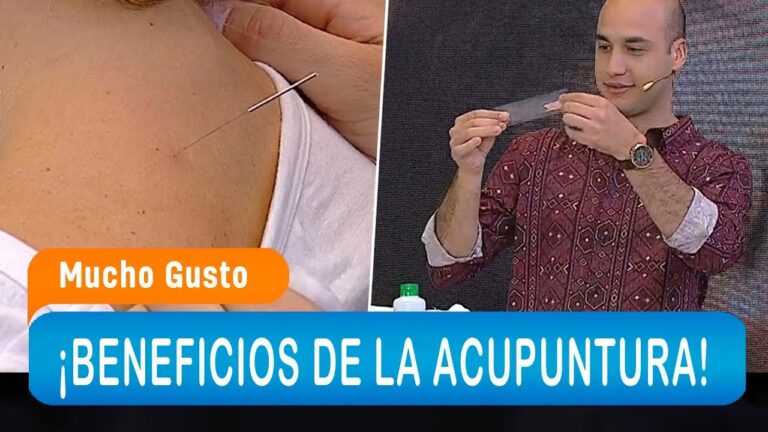 Curso de Acupuntura Estética en Chile: Transformación y Bienestar