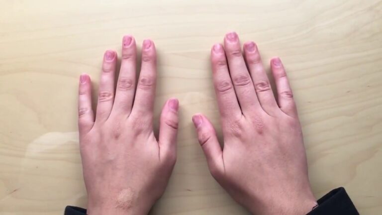 Curso de Terapia de Movimientos R&iacute;tmicos en Chile