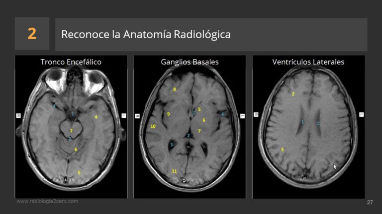 Curso de Radiolog&iacute;a en Parral, Chile: Formaci&oacute;n de Calidad para Profesionales