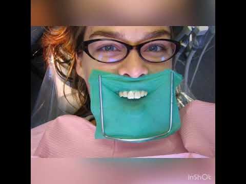 Curso Gratuito de Asistente Dental en Chile