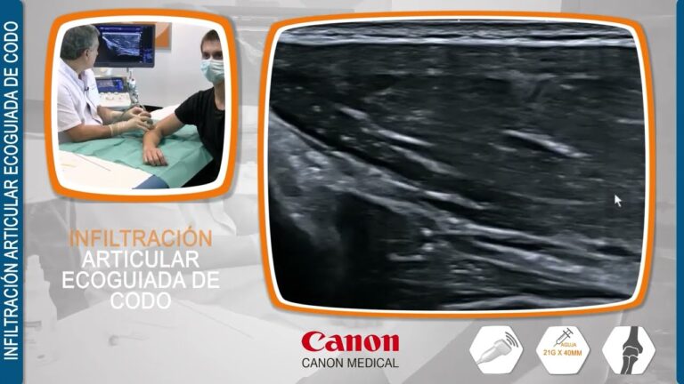 Curso de Infiltraci&oacute;n Articular en Chile