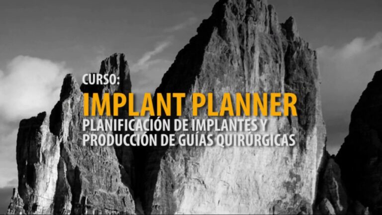 Curso de Implantes Dentales en Chile