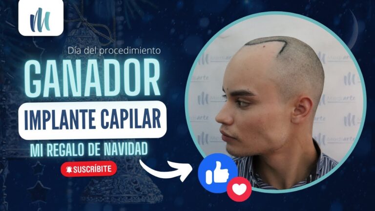Curso Avanzado de Cirug&iacute;a Capilar en Chile