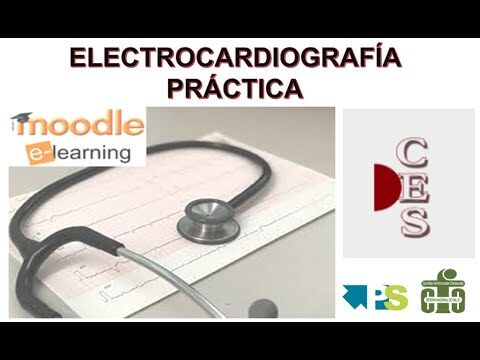 Cursos Presenciales de Electrocardiograma en Santiago de Chile
