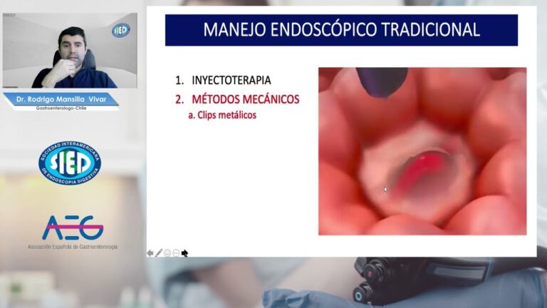 Cursos de Hemostasia en Chile: Formaci&oacute;n Especializada y Oportunidades